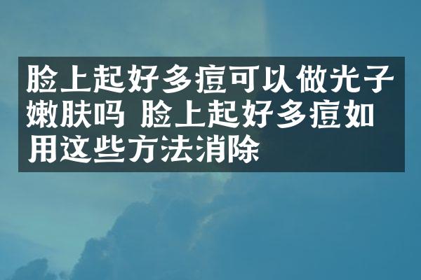 脸上起好多痘可以做光子嫩肤吗 脸上起好多痘如何用这些方法消除