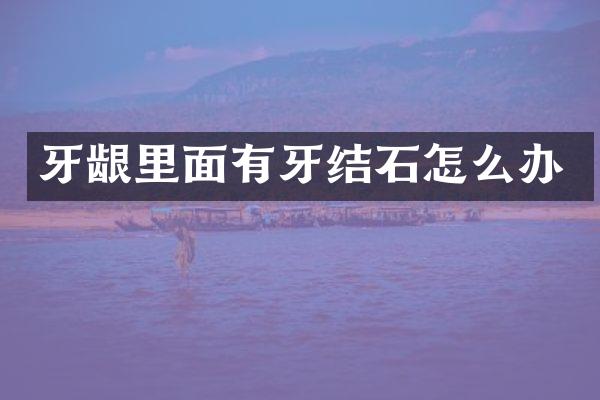 牙龈里面有牙结石怎么办