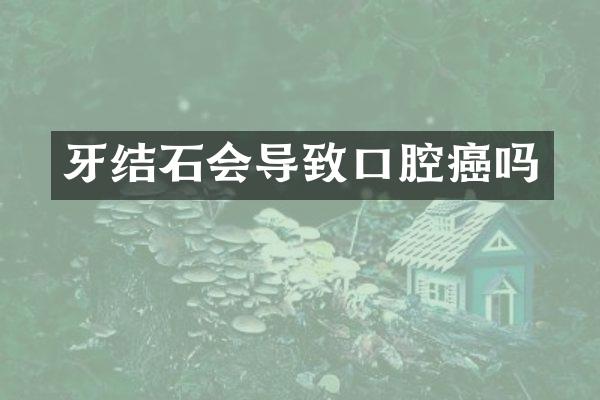 牙结石会导致口腔癌吗